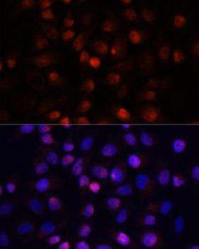 ACP1 / Acid Phosphatase Antibody - Immunofluorescence analysis of HeLa cells using ACP1 Polyclonal Antibody at dilution of 1:100 (40x lens).Blue: DAPI for nuclear staining.