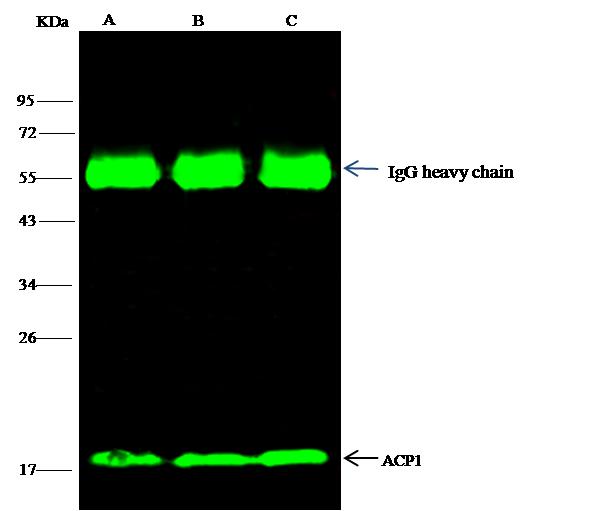 ACP1 / Acid Phosphatase Antibody - ACP1 was immunoprecipitated using: Lane A: 0.5 mg Jurkat Whole Cell Lysate. Lane B: 0.5 mg HepG2 Whole Cell Lysate. Lane C:0.5 mg Hela Whole Cell Lysate. 4 uL anti-ACP1 rabbit polyclonal antibody and 15 ul of 50% Protein G agarose. Primary antibody: Anti-ACP1 rabbit polyclonal antibody, at 1:100 dilution. Secondary antibody: Dylight 800-labeled antibody to rabbit IgG (H+L), at 1:5000 dilution. Developed using the odssey technique. Performed under reducing conditions. Predicted band size: 18 kDa. Observed band size: 18 kDa.
