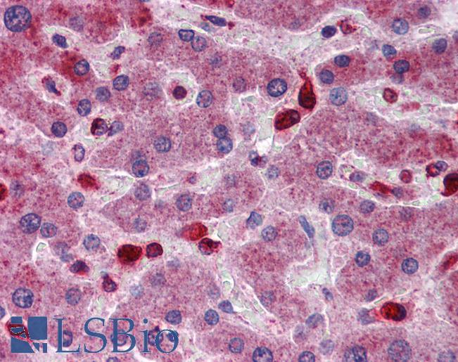 ACP2 / Acid Phosphatase 2 Antibody - Anti-ACP2 / Acid Phosphatase 2 antibody IHC of human liver. Immunohistochemistry of formalin-fixed, paraffin-embedded tissue after heat-induced antigen retrieval. Antibody concentration 5 ug/ml.  This image was taken for the unconjugated form of this product. Other forms have not been tested.