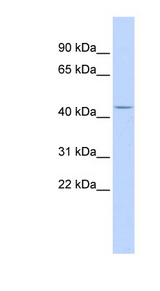 ACP2 / Acid Phosphatase 2 Antibody - ACP2 / Acid Phosphatase 2 antibody Western blot of Fetal Brain lysate. This image was taken for the unconjugated form of this product. Other forms have not been tested.