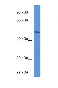 ACP2 / Acid Phosphatase 2 Antibody - ACP2 / Acid Phosphatase 2 antibody Western blot of Rat Kidney lysate. Antibody concentration 1 ug/ml. This image was taken for the unconjugated form of this product. Other forms have not been tested.