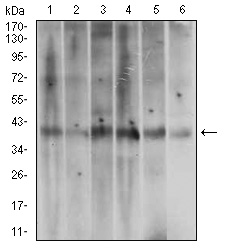 ACP5 / TRAP Antibody - Western blot using ACP5 mouse monoclonal antibody against A431 (1), T47D (2), HepG2 (3), MOLT4 (4), Jurkat (5) and HeLa (6) cell lysate.