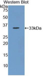 ACP5 / TRAP Antibody - Western blot of recombinant ACP5 / TRAP.