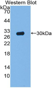 ACP5 / TRAP Antibody - Western Blot; Sample: Recombinant protein.