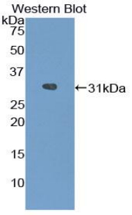 ACP5 / TRAP Antibody - Western blot of recombinant ACP5 / TRAP.  This image was taken for the unconjugated form of this product. Other forms have not been tested.