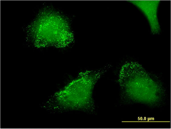 ACP5 / TRAP Antibody - Immunofluorescence of monoclonal antibody to ACP5 on HeLa cell . [antibody concentration 10 ug/ml]