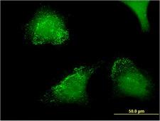 ACP5 / TRAP Antibody - Immunofluorescence of monoclonal antibody to ACP5 on HeLa cell . [antibody concentration 10 ug/ml]