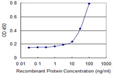 ACP5 / TRAP Antibody - Detection limit for recombinant GST tagged ACP5 is 1 ng/ml as a capture antibody.