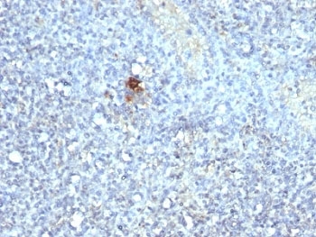 ACP5 / TRAP Antibody - Formalin-fixed, paraffin-embedded human spleen stained with TRAcP antibody (ACP5/1070).  This image was taken for the unmodified form of this product. Other forms have not been tested.
