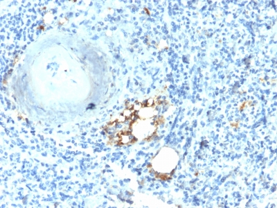 ACP5 / TRAP Antibody - Formalin-fixed, paraffin-embedded human Spleen stained with TRAcP Rabbit Recombinant Monoclonal Antibody (ACP5/2336R).