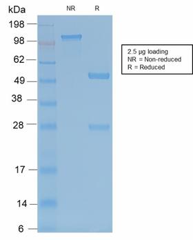 ACP5 / TRAP Antibody - SDS-PAGE Analysis of Purified TRAcP Rabbit Recombinant Monoclonal Antibody (ACP5/2336R). Confirmation of Purity and Integrity of Antibody.