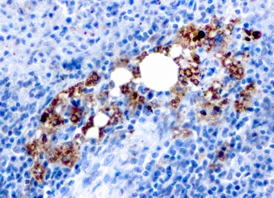 ACP5 / TRAP Antibody - Formalin-fixed, paraffin-embedded human Spleen stained with TRAcP Mouse Recombinant Monoclonal Antibody (rACP5/1070).