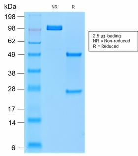 ACP5 / TRAP Antibody - SDS-PAGE Analysis of Purified TRAcP Mouse Recombinant Monoclonal Antibody (rACP5/1070). Confirmation of Purity and Integrity of Antibody.