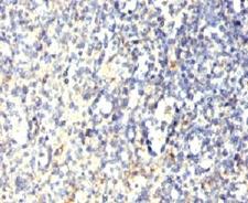 ACP5 / TRAP Antibody - Formalin-fixed, paraffin-embedded human spleen stained with TRAcP antibody (SPM601).  This image was taken for the unmodified form of this product. Other forms have not been tested.
