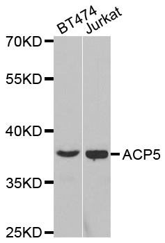 ACP5 / TRAP Antibody - Western blot analysis of extracts of various cell lines.