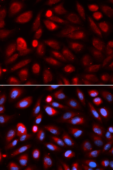 Anti-ACP5 / TRAP Antibody | Rabbit anti-Human Polyclonal IF,IHC,WB | LSBio