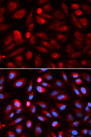 ACP5 / TRAP Antibody - Immunofluorescence analysis of U2OS cells.