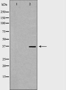 ACP5 / TRAP Antibody - Western blot analysis of Jurkat whole cells lysates using ACP5 antibody. The lane on the left is treated with the antigen-specific peptide.