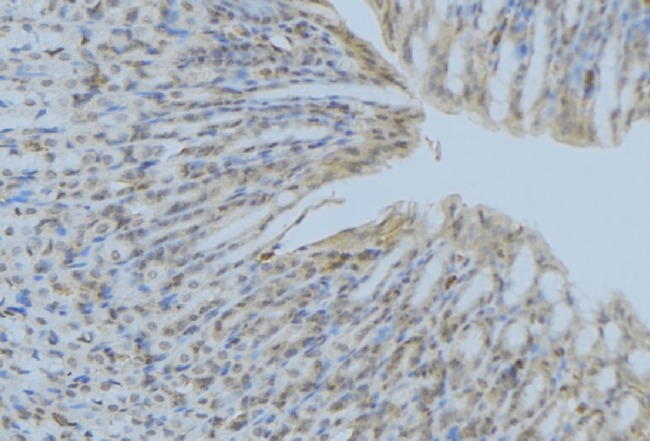 ACP5 / TRAP Antibody - 1:100 staining human gastric tissue by IHC-P. The sample was formaldehyde fixed and a heat mediated antigen retrieval step in citrate buffer was performed. The sample was then blocked and incubated with the antibody for 1.5 hours at 22°C. An HRP conjugated goat anti-rabbit antibody was used as the secondary.
