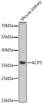 ACP5 / TRAP Antibody - Western blot analysis of extracts of Mouse kidney using ACP5 Polyclonal Antibody at dilution of 1:1000.