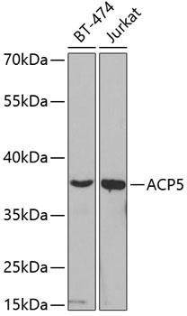 ACP5 / TRAP Antibody - Western blot analysis of extracts of various cell lines using ACP5 Polyclonal Antibody at dilution of 1:200.