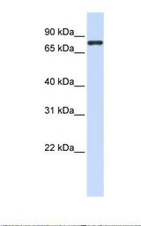 ACP6 Antibody - 293T cell lysate. Antibody concentration: 1.0 ug/ml. Gel concentration: 12%.  This image was taken for the unconjugated form of this product. Other forms have not been tested.