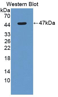 ACP6 Antibody - Western Blot; Sample: Recombinant protein.