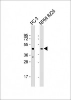 ACP6 Antibody - All lanes: Anti-ACP6 Antibody (Center) at 1:2000 dilution Lane 1: PC-3 whole cell lysate Lane 2: RPMI 8226 whole cell lysate Lysates/proteins at 20 µg per lane. Secondary Goat Anti-Rabbit IgG, (H+L), Peroxidase conjugated at 1/10000 dilution. Predicted band size: 49 kDa Blocking/Dilution buffer: 5% NFDM/TBST.