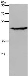 ACP6 Antibody - Western blot analysis of K562 cell, using ACP6 Polyclonal Antibody at dilution of 1:200.