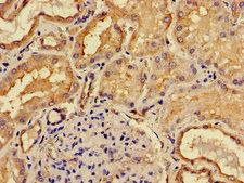 ACP6 Antibody - Immunohistochemistry image of paraffin-embedded human kidney tissue at a dilution of 1:100