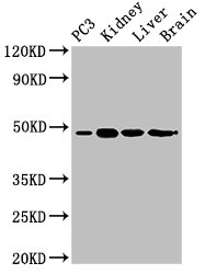 ACP6 Antibody - Positive Western Blot detected in PC3 whole cell lysate, Mouse kidney tissue, Mouse liver tissue, Rat brain tissue. All lanes: ACP6 antibody at 3 µg/ml Secondary Goat polyclonal to rabbit IgG at 1/50000 dilution. Predicted band size: 49, 31 KDa. Observed band size: 49 KDa