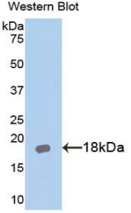 AcPL / IL18RAP Antibody - Western blot of recombinant AcPL / IL18RAP.  This image was taken for the unconjugated form of this product. Other forms have not been tested.