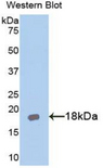 AcPL / IL18RAP Antibody - Western blot of recombinant AcPL / IL18RAP.  This image was taken for the unconjugated form of this product. Other forms have not been tested.