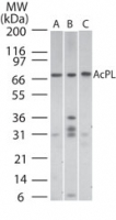 AcPL / IL18RAP Antibody - Western blot of AcPL in (A) human spleen, (B) mouse spleen, and (C) mouse RAW cell lysate using antibody at 2 ug/ml.