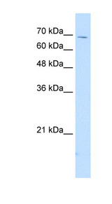 AcPL / IL18RAP Antibody - IL18RAP antibody ARP42154_T100-NP_003844-IL18RAP(interleukin 18 receptor accessory protein) Antibody Western blot of HepG2 cell lysate.  This image was taken for the unconjugated form of this product. Other forms have not been tested.