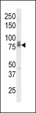 AcPL / IL18RAP Antibody - Western blot of IL18RAP Antibody in K562 cell line lysates (35 ug/lane). IL18RAP (arrow) was detected using the purified antibody.