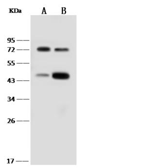 AcPL / IL18RAP Antibody - Anti-IL1R7 rabbit monoclonal antibody at 1:500 dilution. Lane A: RAW264.7 Whole Cell Lysate. Lane B: K562 Whole Cell Lysate. Lysates/proteins at 30 ug per lane. Secondary: Goat Anti-Rabbit IgG (H+L)/HRP at 1/10000 dilution. Developed using the ECL technique. Performed under reducing conditions. Predicted band size: 68 kDa. Observed band size: 75 kDa.