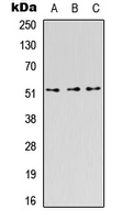 AcPL / IL18RAP Antibody - Western blot analysis of CD218b expression in HEK293T (A); Raw264.7 (B); H9C2 (C) whole cell lysates.