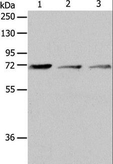AcPL / IL18RAP Antibody - Western blot analysis of RAW264.7 cell and human liver cancer tissue, SP20 cell, using IL18RAP Polyclonal Antibody at dilution of 1:650.