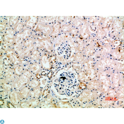 AcPL / IL18RAP Antibody - Immunohistochemical analysis of paraffin-embedded human-kidney, antibody was diluted at 1:200.
