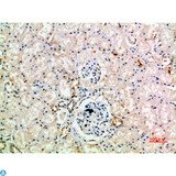AcPL / IL18RAP Antibody - Immunohistochemical analysis of paraffin-embedded human-kidney, antibody was diluted at 1:200.