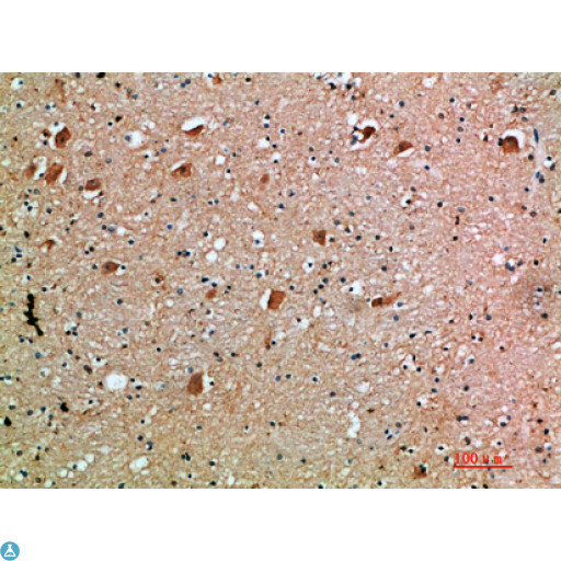 AcPL / IL18RAP Antibody - Immunohistochemical analysis of paraffin-embedded human-brain, antibody was diluted at 1:200.