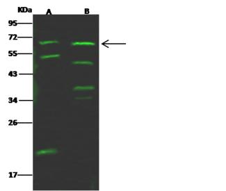 AcPL / IL18RAP Antibody - Anti-IL1R7 rabbit polyclonal antibody at 1:500 dilution. Lane A: RAW264.7 Whole Cell Lysate. Lane B: K562 Whole Cell Lysate. Lysates/proteins at 30 ug per lane. Secondary: Goat Anti-Rabbit IgG H&L (Dylight 800) at 1/10000 dilution. Developed using the Odyssey technique. Performed under reducing conditions. Predicted band size: 68 kDa. Observed band size: 66 kDa. (We are unsure as to the identity of these extra bands.)