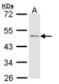 ACPP / PAP Antibody - Sample (30 ug of whole cell lysate). A: Molt-4 . 10% SDS PAGE. ACPP antibody diluted at 1:1000.
