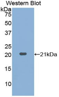 ACPP / PAP Antibody - Western blot of recombinant ACPP / PAP.  This image was taken for the unconjugated form of this product. Other forms have not been tested.