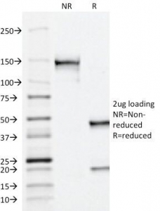 ACPP / PAP Antibody - SDS-PAGE Analysis of Purified, BSA-Free PSAP Antibody (ACCP/1338). Confirmation of Integrity and Purity of the Antibody.