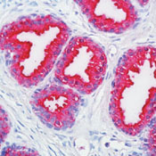 ACPP / PAP Antibody - Formalin-fixed, paraffin-embedded human prostate stained with alkaline phosphatase-conjugate and fast red chromogen. Note intense cytoplasmic staining of glandular epithelial cells.  This image was taken for the unmodified form of this product. Other forms have not been tested.