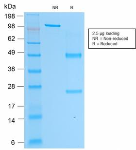 ACPP / PAP Antibody - SDS-PAGE Analysis Purified PSAP Mouse Monoclonal Antibody (rACPP/1338). Confirmation of Purity and Integrity of Antibody.