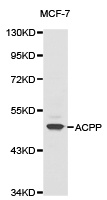 ACPP / PAP Antibody - Western blot of extracts of MCF-7 cell line, using ACPP antibody.