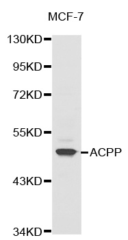 ACPP / PAP Antibody - Western blot analysis of extracts of MCF-7 cells.